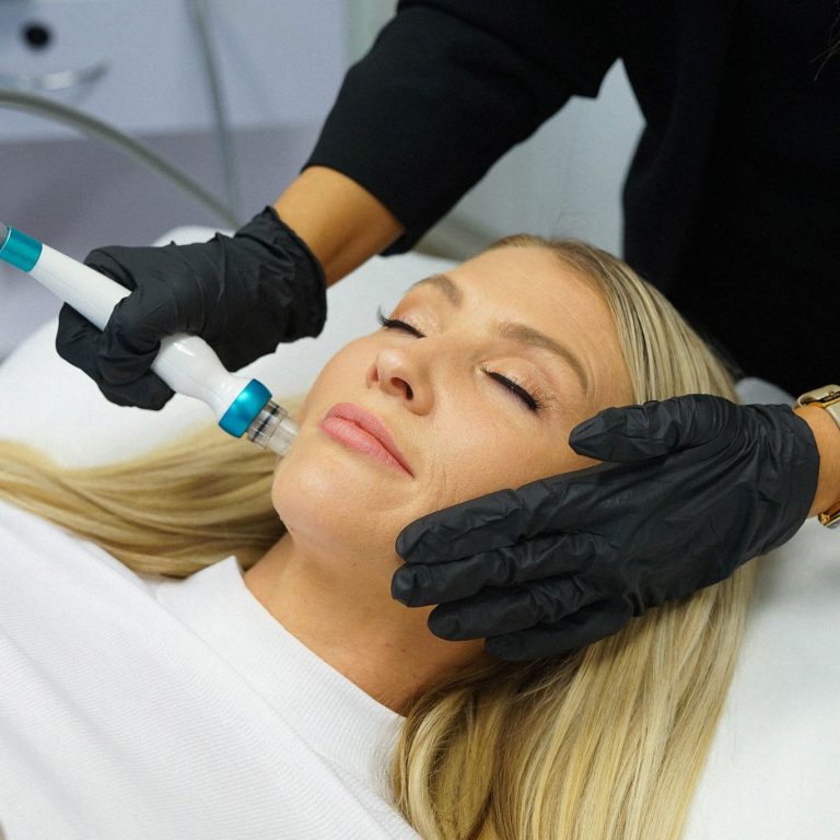 Skin Needling and Micro Needling Skinlux Face and Body