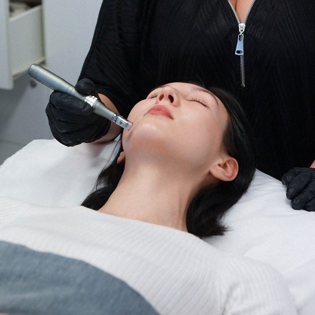 Skin Needling and Micro Needling Skinlux Face and Body
